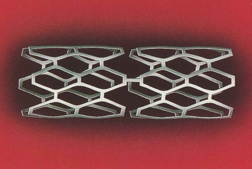 Illustration of the PALMAZ-SCHATZ® Balloon-Expandable Stent, from our archives.